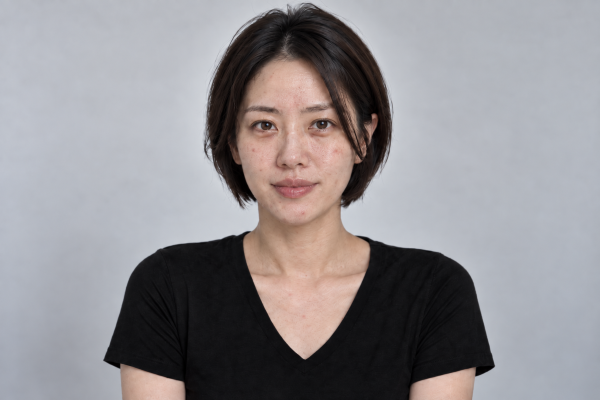 논현역 피부과 에티튜드의원 피부관리 받기 전 피부 상태